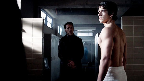 Capa do Seriado Teen Wolf Episódio S01E10